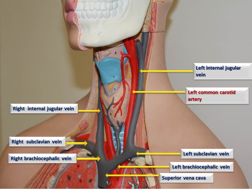 Internal access. Internal jugular Vein на УЗИ. Catheterization of the Internal jugular Vein scheme.